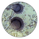 Common fungal spores (Aspergillus fumigatus)